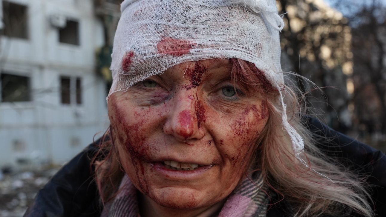 24 February: A woman wounded following a Russian air strike on an apartment complex outside Kharkiv, Ukraine’s second largest city