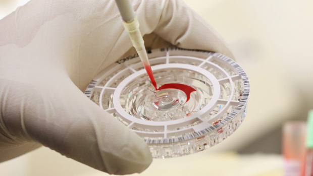 Ebola blood sample