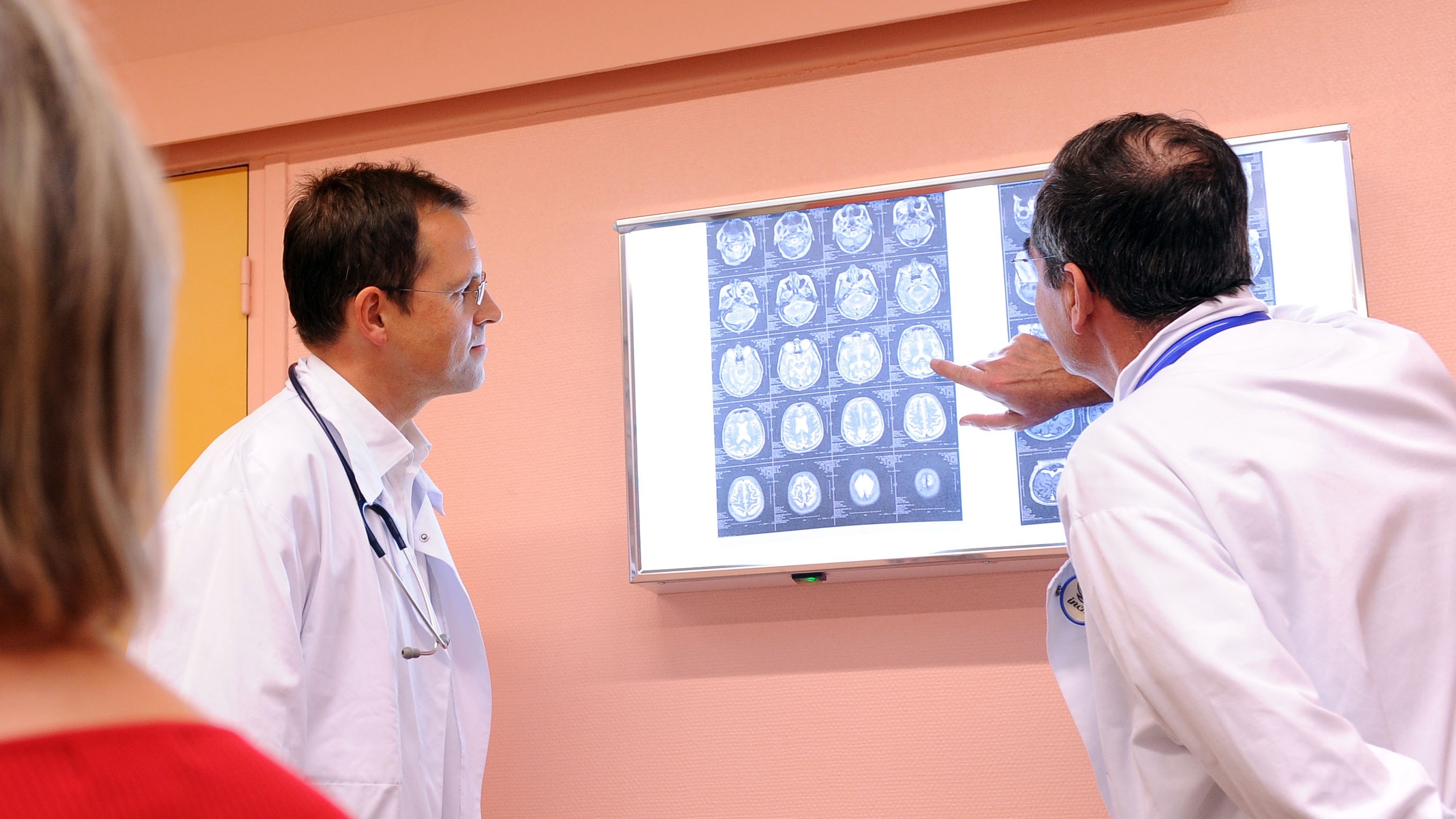 Alzheimer&#039;s brain scan